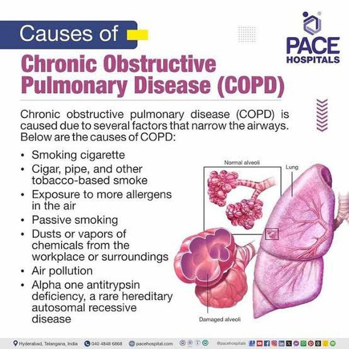 Chronic Obstructive Pulmonary Disease IV