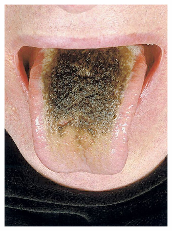 Interesting medical case !!!