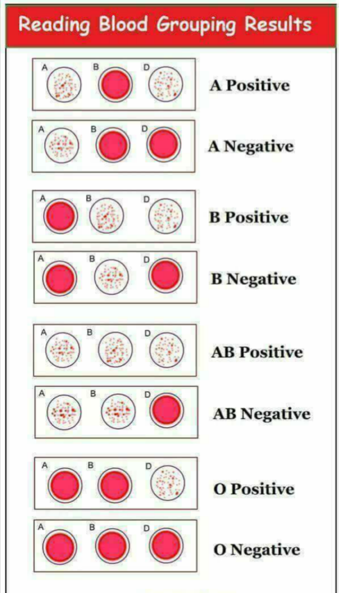 Blood group are easy...