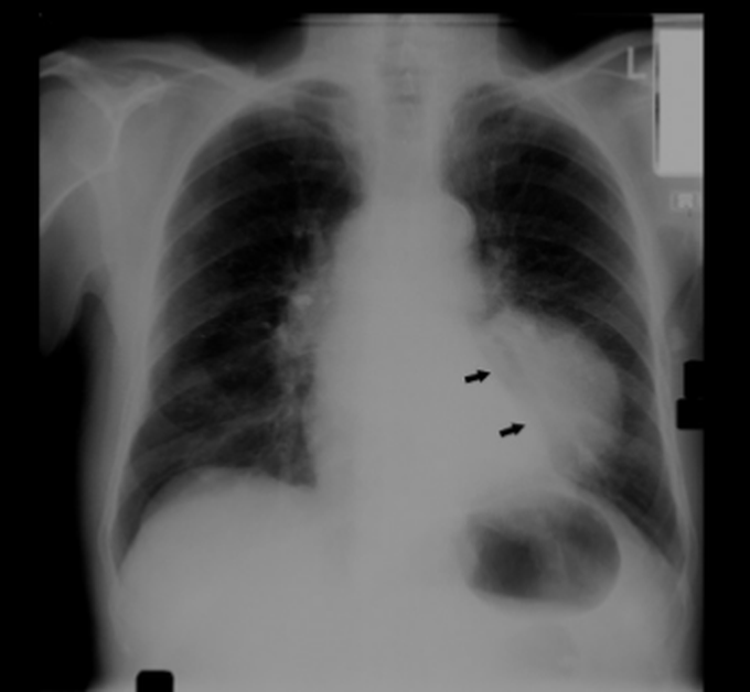 Diagnosis?