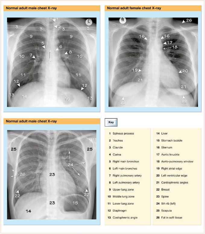 All about heart locations(See in key chart)