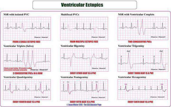 Ecg - Medizzy