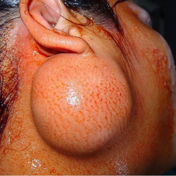 What's your diagnosis.