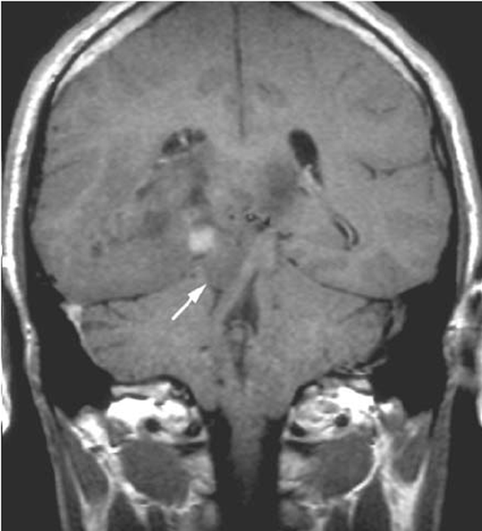 Diagnosis?