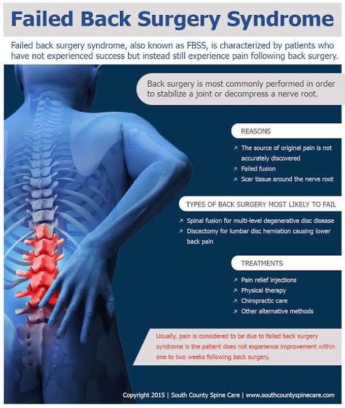 Failed back surgery syndrome symptoms