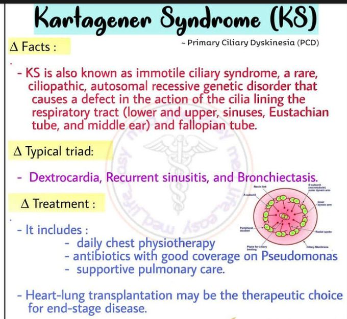 Kartagener syndrome