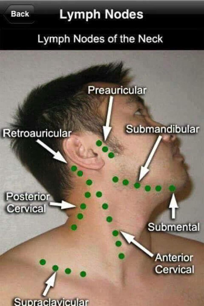 Linfonodos cabeza cuello | Phleb stuff | Pinterest | Medical, Nurse practitioner and Dental