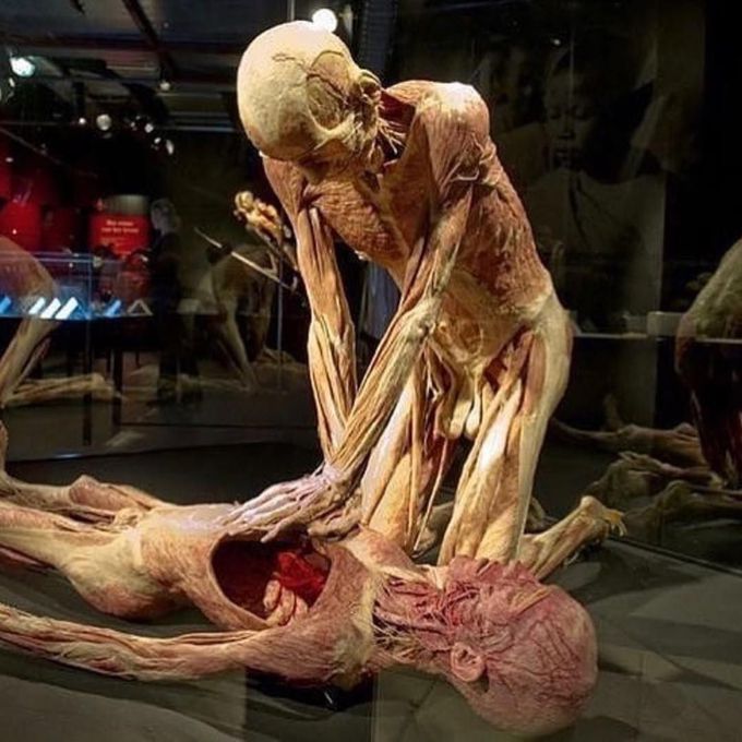 Cardiopulmonary resuscitation