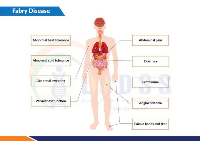 Types of fabry's disease