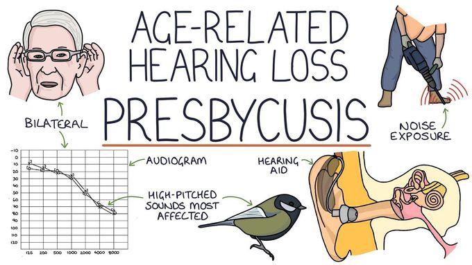Understanding Presbycusis: Age-Related Hearing Loss