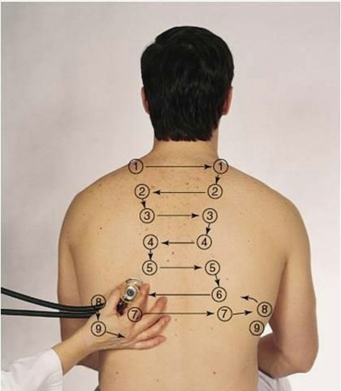 Auscultation