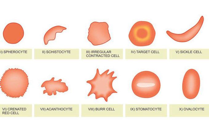 Red cell abnormalities