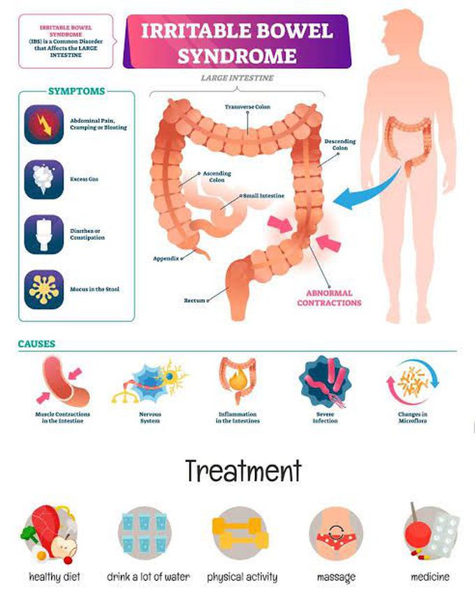 What is irritable bowel syndrome?