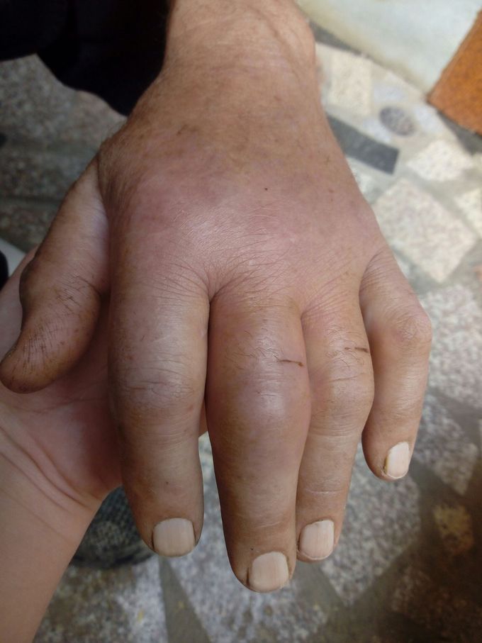 Diagnosis??