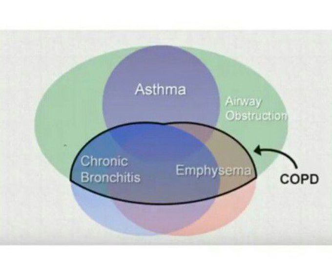 Obstructive Respiratory Diseases - Medizzy