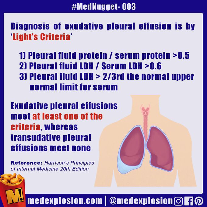 Light's criteria for pleural effusion
