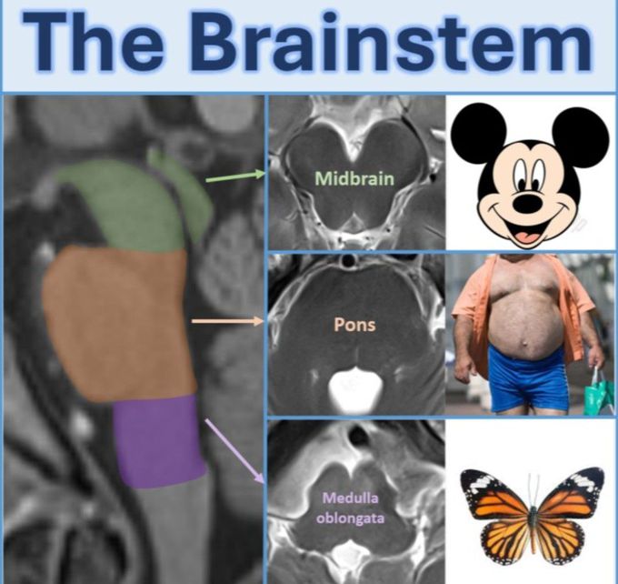 Basic Brainstem Radiology