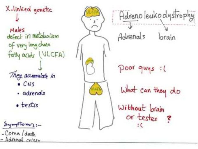 Symptoms of Adrenoleukodystrophy