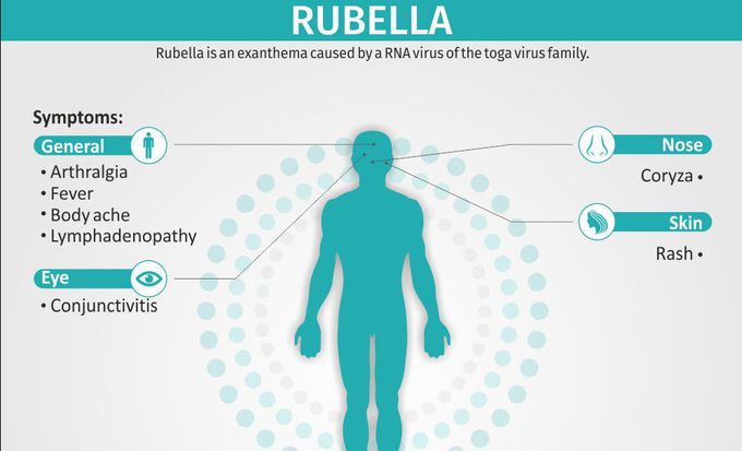 Symptoms of Rubella