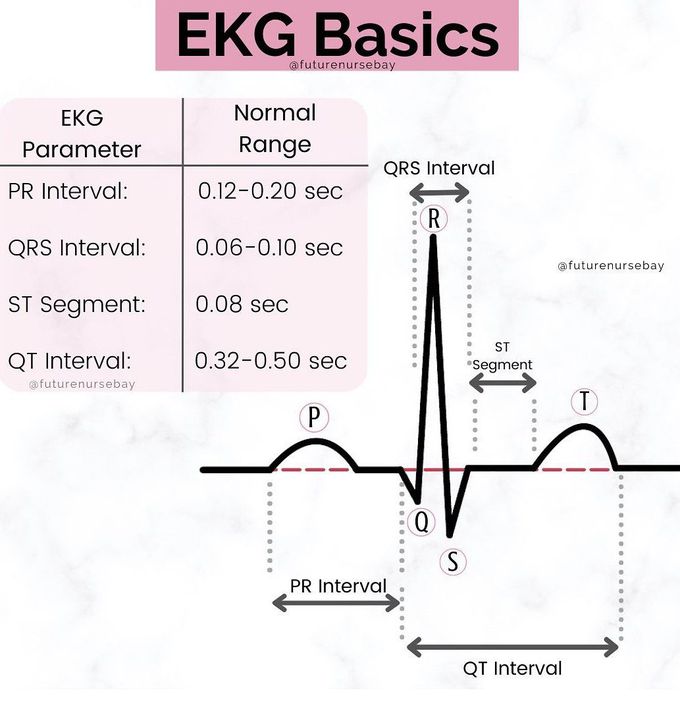 EKG Basics