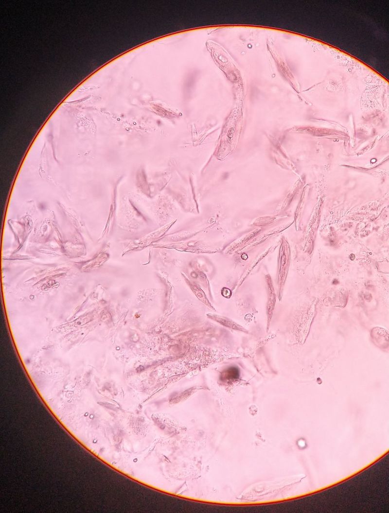 Epithelial cells in urine - MEDizzy