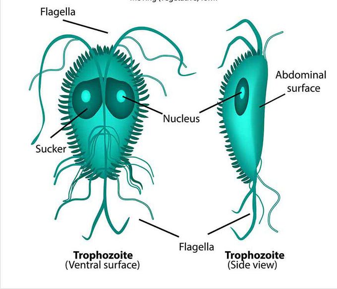 Giardiasis