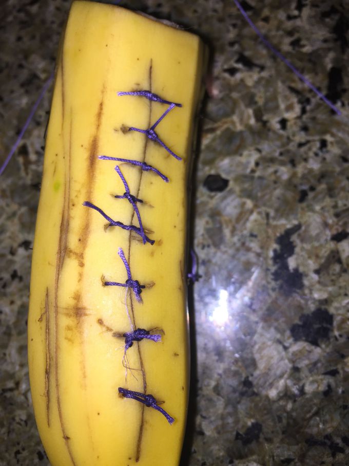 banana sutures!