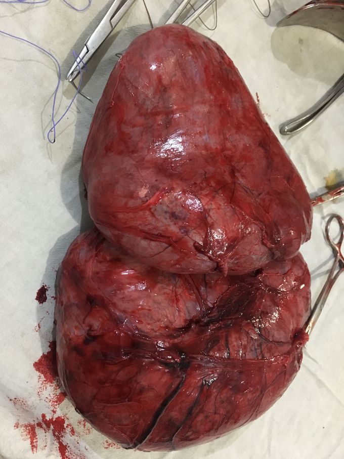 Mcan you dx what it is??