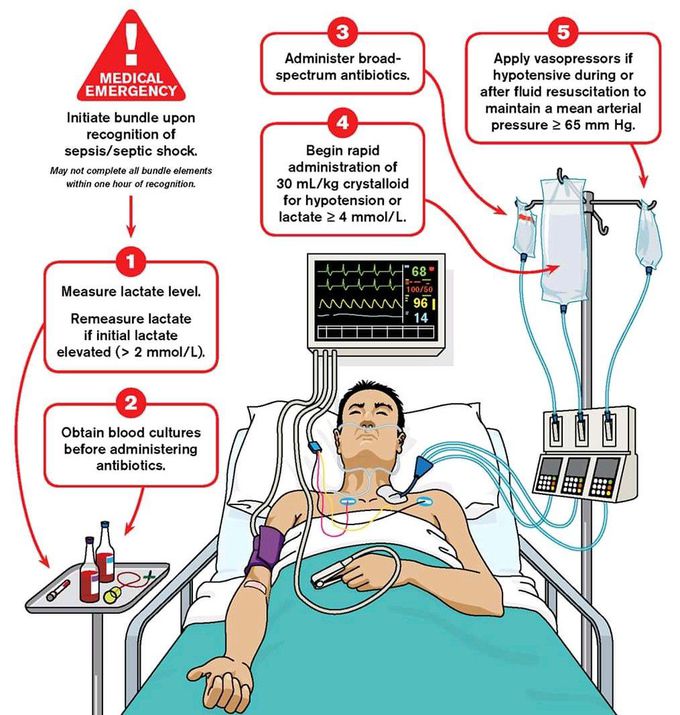 Initial resuscitation for sepsis and septic shock