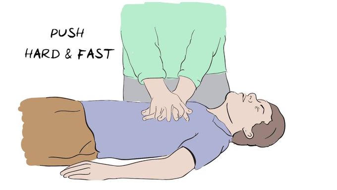 How To Do CPR - Animated Video