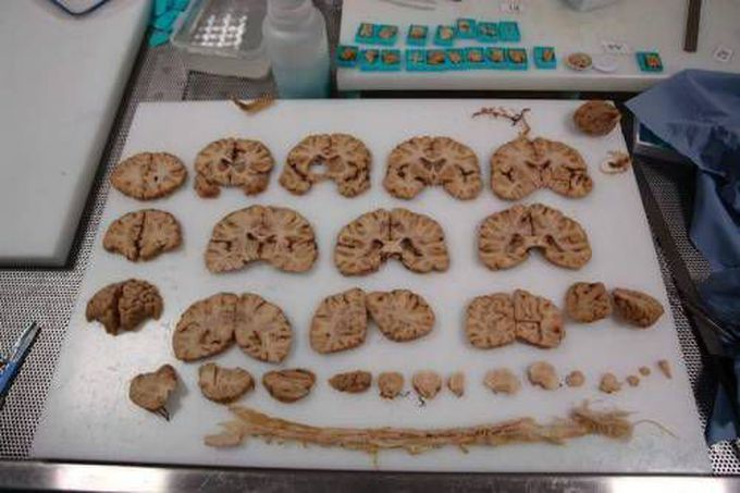 Dissection of the central nervous system.