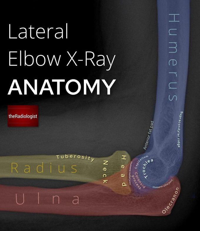 Elbow X-ray Anatomy- II