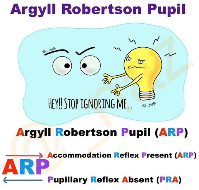 Argyll Robertson pupil