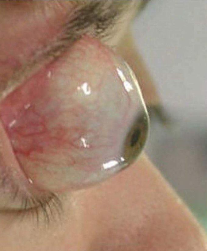 What is your diagnosis ??