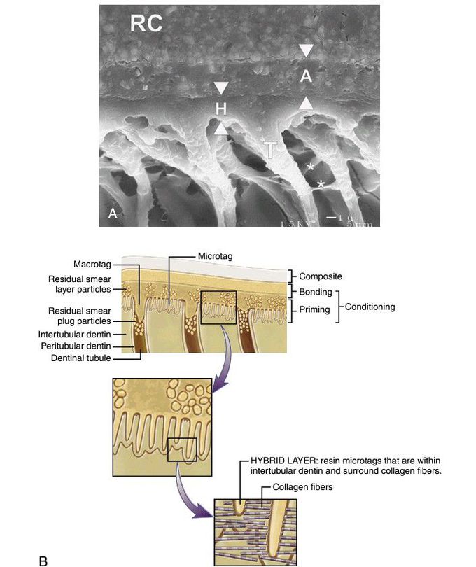 Adhesion to dentin.