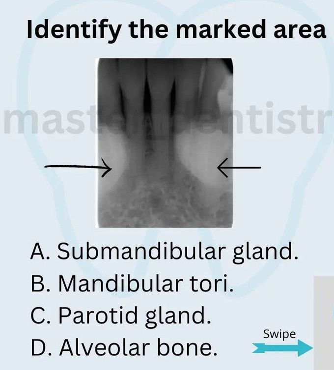 Identify