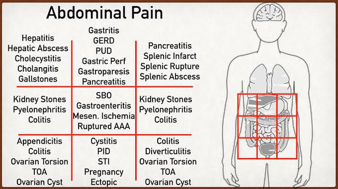 Abdominal pain locations
