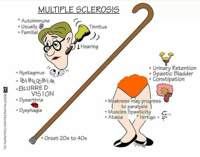 Multiple Sclerosis