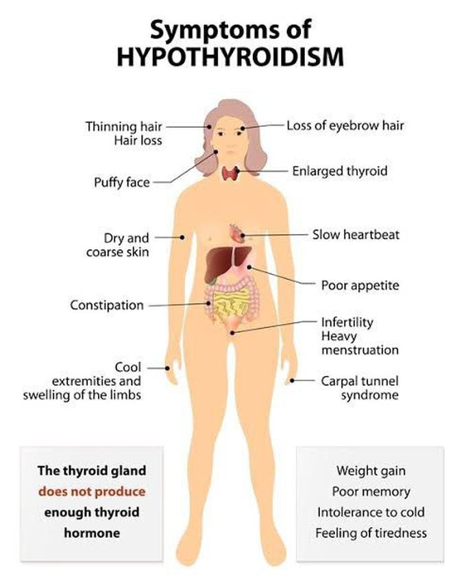 These are the symptoms of hypothroidism