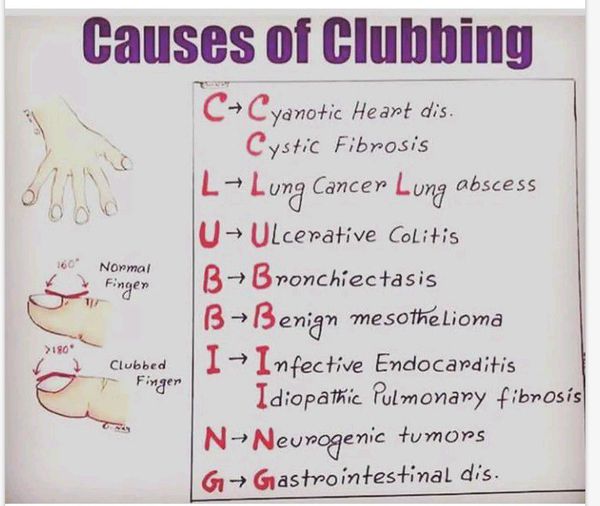 Clubbing