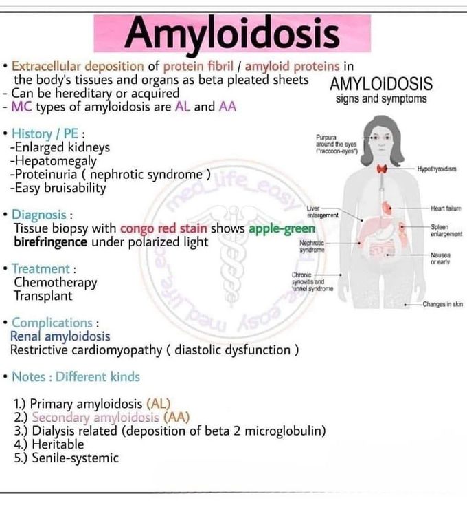 Amyloidosis