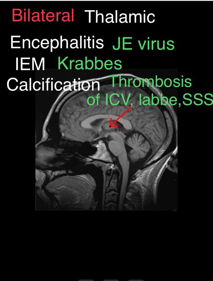 Thalamus and associations