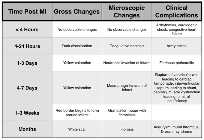 Complications of Myocardial Infarction