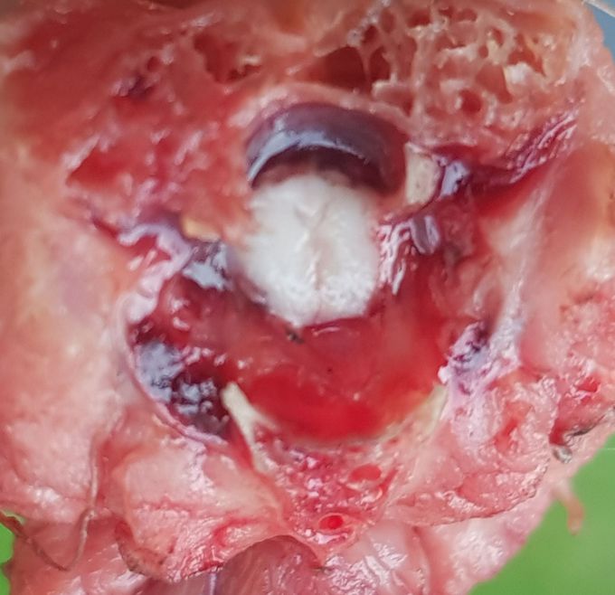 Spinal Cord (chicken)