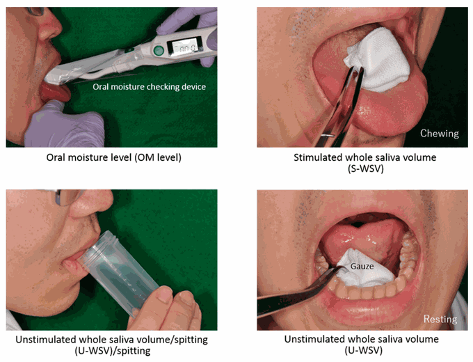 Sialometry