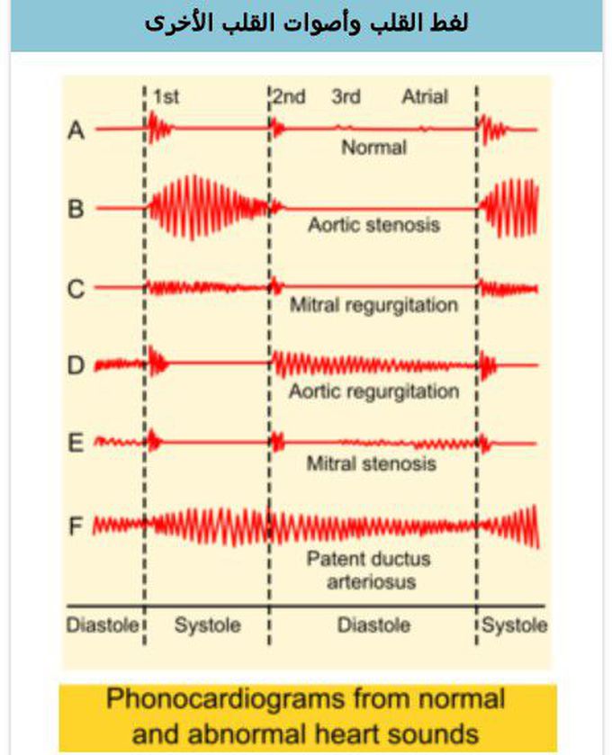 Heart sounds