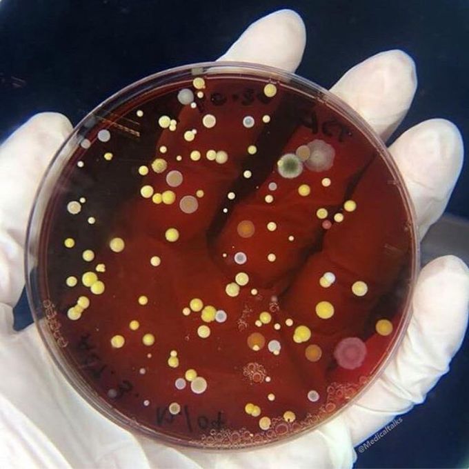Bacterial Growth