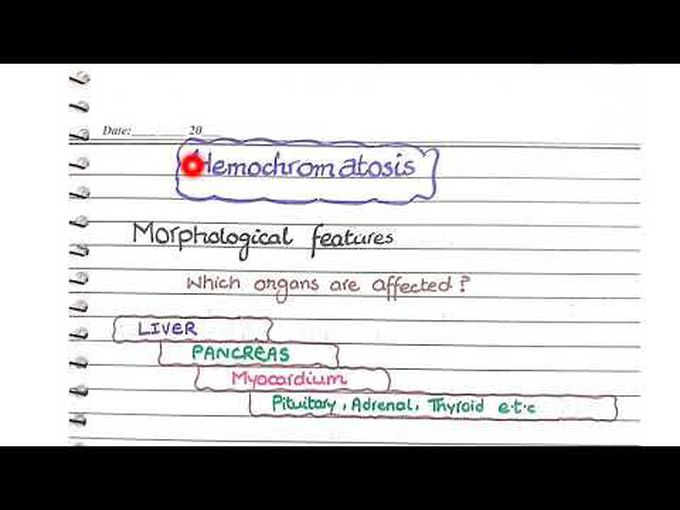 What is Hemochromatosis