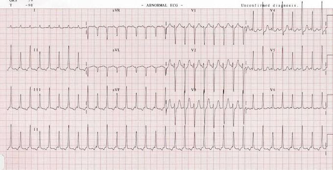 What's your diagnosis?