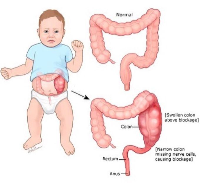 🔸 Guess the diagnosis !!